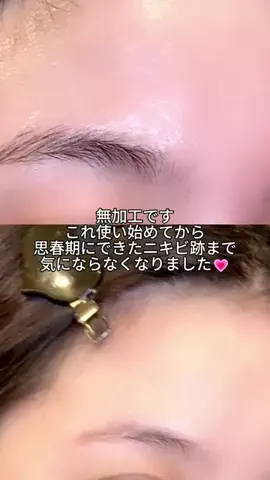 yui@垢抜けのTikTok投稿
