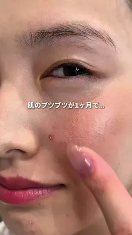 心配嬢👸🏻のTikTok投稿