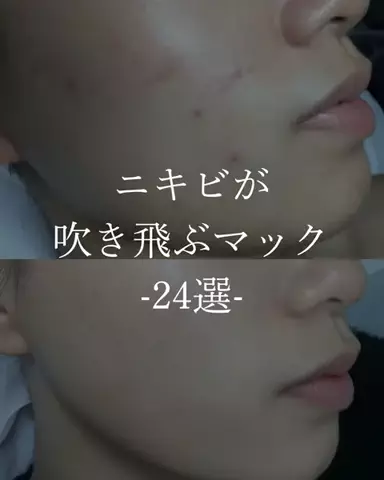 ダン|美容ガチレビューのTikTok投稿