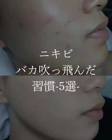 ダン|美容ガチレビューのTikTok投稿
