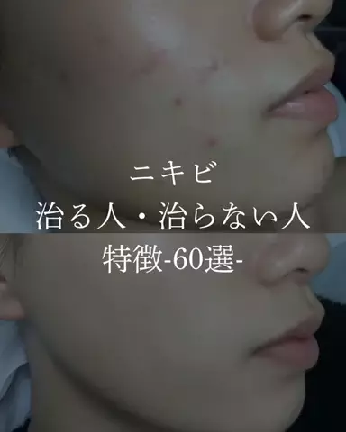 ダン|美容ガチレビューのTikTok投稿