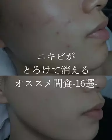 ダン|美容ガチレビューのTikTok投稿