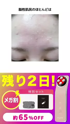 KotoのTikTok投稿