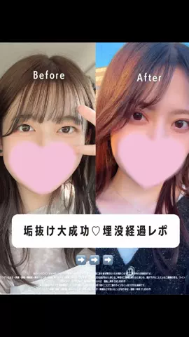 自分磨きちゃんのTikTok投稿