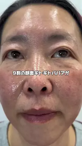 マダム美容✨のTikTok投稿