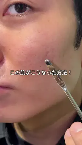 正直美容【メンズ】のTikTok投稿