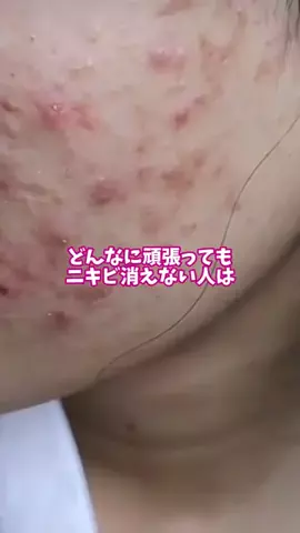 SUUちゃん🐏睡眠改善療法士のTikTok投稿