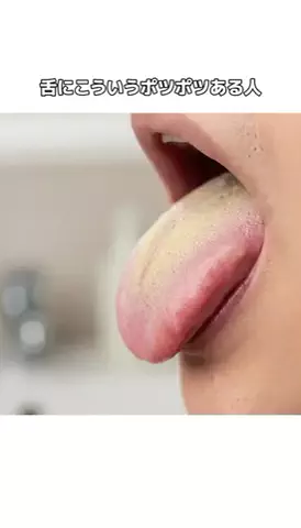 𝕄𝕠𝕖𝕜𝕒のTikTok投稿
