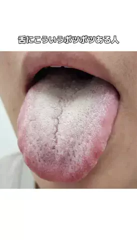 𝕄𝕠𝕖𝕜𝕒のTikTok投稿