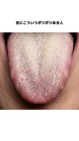𝕄𝕠𝕖𝕜𝕒のTikTok投稿