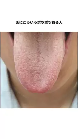 𝕄𝕠𝕖𝕜𝕒のTikTok投稿