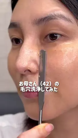 ハナマル｜垢抜け記録のTikTok投稿