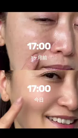 ハナマル｜垢抜け記録のTikTok投稿