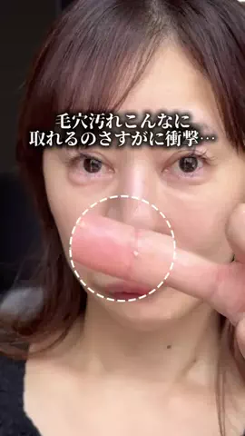 ハナマル｜垢抜け記録のTikTok投稿