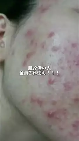 leherfhibodm9539のTikTok投稿