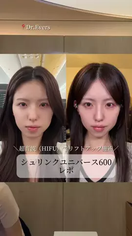 一瀬優美のTikTok投稿