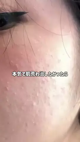 つや肌ちゃん【美容】のTikTok投稿