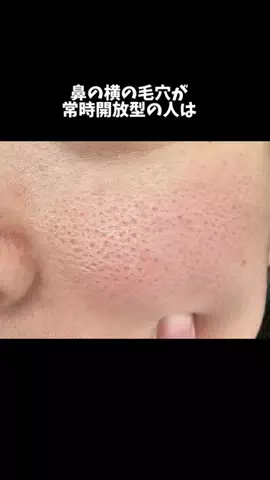 骨格ストレートちゃんのTikTok投稿