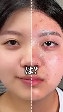 みうみう🍓のTikTok投稿