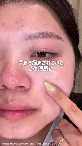 みうみう🍓のTikTok投稿