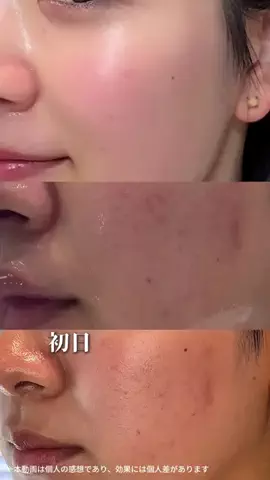 みうみう🍓のTikTok投稿