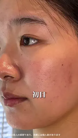 みうみう🍓のTikTok投稿