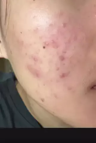 在宅美容マニアのTikTok投稿