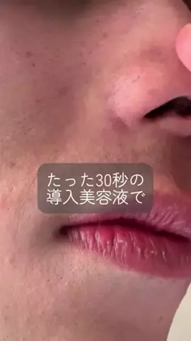 汚肌のミカタのTikTok投稿