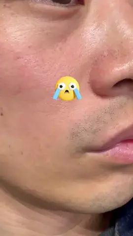 汚肌のミカタのTikTok投稿
