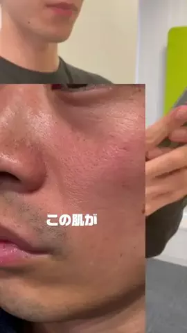 汚肌のミカタのTikTok投稿