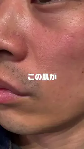 汚肌のミカタのTikTok投稿