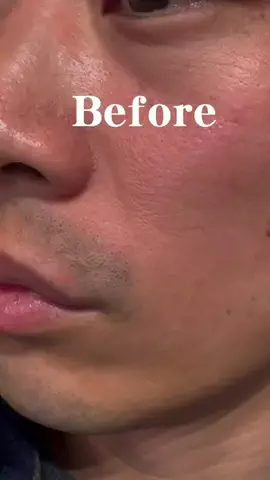 汚肌のミカタのTikTok投稿