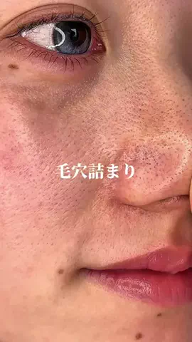 もちもちもち子🤍のTikTok投稿