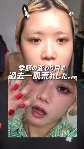 (株)佐藤そるとのTikTok PR投稿：季節の変わり目って肌管理むずかしすぎる🥲 最近はバリ…