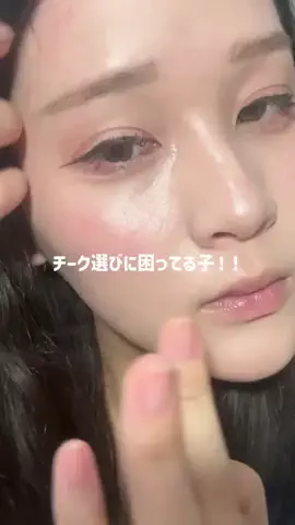 先天性眼瞼下垂(ゆな)のTikTok投稿