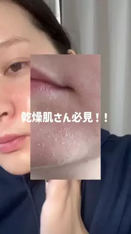 先天性眼瞼下垂(ゆな)のTikTok投稿