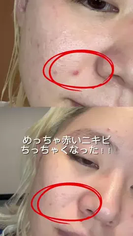 ｻｴﾁｬﾝﾏﾝのTikTok投稿