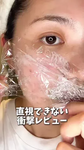 ゆい〻美容クリニック勤務のTikTok投稿