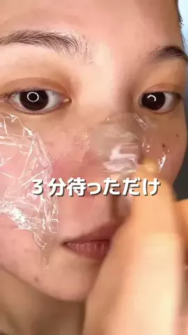 ゆい〻美容クリニック勤務のTikTok投稿