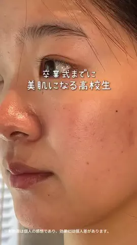 みうみう🍓のTikTok投稿