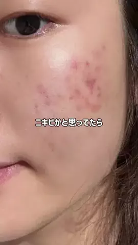 みく🎀垢抜け研究中のTikTok投稿