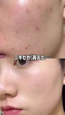 みく🎀垢抜け研究中のTikTok投稿