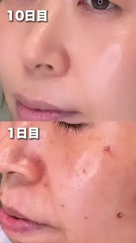さとみ | アラフォー美容💄のTikTok投稿