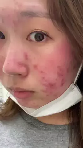 かほ | ダイエット & 歯列矯正中🦷のTikTok投稿