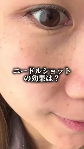yuriのTikTok投稿