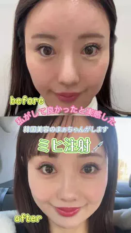 MASAMIのTikTok投稿
