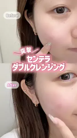 突撃ちゃん🩰🪄【美容トレンド速報】のTikTok投稿