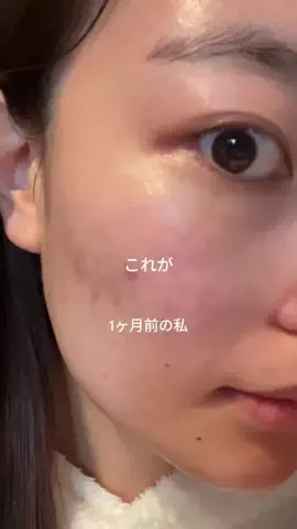 mizukiのTikTok PR投稿：これがこうなった理由🫧 #pr #毛穴 #スキンケア #美容液 #c…