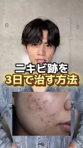 コンプレックスニキのTikTok投稿
