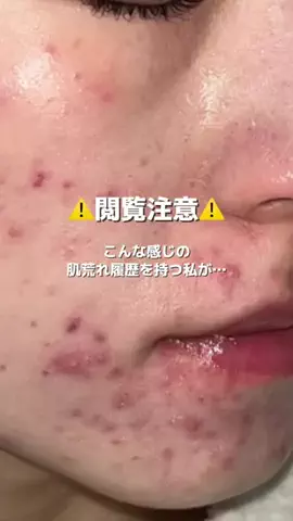 きららのTikTok投稿